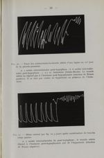 Fig. 10. - Tracé des contractions du muscle utérin d'une lapine au 12e jour de la pseudo-grossesse / [...]