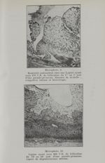 Microphoto. 9. Bourrelet endométral chez une lapine ayant reçu 470 U.R. de folliculine du 1er au 7 j [...]