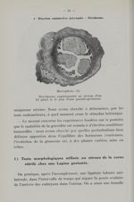 Microphoto. 15. Déciduome expérimental au niveau d'un fil placé au 6e jour d'une pseudo-grossesse -  [...]