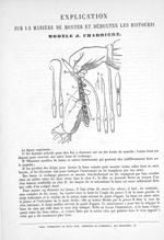 Modèle J. Charrière - Note accompagnée de planches représentant les instruments nouveaux et particul [...]