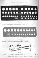 Fig. 571. Filière pour les bougies de Beniqué et Guyon/ Fig. 572. Filière Charrière pour sondes et b [...]