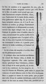 Fig. 2. Perforateur applati - Leçons de physiologie expérimentale appliquée à la médecine, faites au [...]