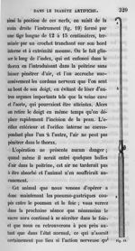 Fig. 19. Instrument enfoncé dans le thorax pour accrocher les cordons nerveux - Leçons de physiologi [...]