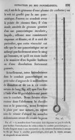 Fig. 25. Petit tube d'argent introduit dans le conduit pancréatique - Leçons de physiologie expérime [...]