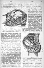 Fig. 556. Situation de l'utérus arrivé à un degré avancé de grossesse, dans le décubitus dorsal de l [...]