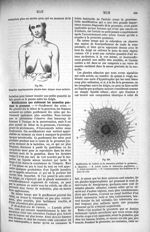 Fig. 832. Mamelles supplémentaires placées dans chaque creux axillaire / Fig. 833. Modification de l [...]