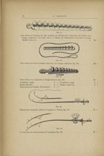 Fig. 95. - Série d'olives de Neuman pour l'électrolyse de l'urèthre avec bougie conductrice / Fig. 9 [...]