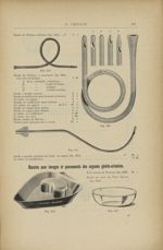 Fig. 649. - Sonde de Nélaton ordinaire / Fig. 650. - Sonde de Nélaton, à entonnoir / Fig. 651. - Son [...]