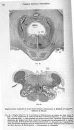 Dégénérations consécutives à une lésion bulbaire (observation de Babinski et Nageotte). Méthode de M [...]