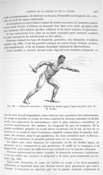 Fig. 193. Démarche sournoise. Moment du double apui - Traité de physique biologique. Tome premier