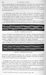 Fig. 200. Transition du pas au trot/ Fig. 201. Transition du trot au pas - Traité de physique biolog [...]