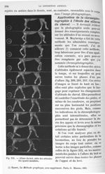 Fig. 212. Allure du trot, série des attitudes des quatre membres - Traité de physique biologique. To [...]