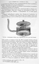 Fig. 305. Cardiographe de Marey pour l'exploration du choc du cœur chez l'homme - Traité de physique [...]