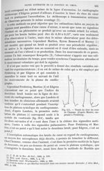 Fig. 311. Tracés du choc du cœur de l'homme - Traité de physique biologique. Tome premier