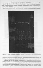 Fig. 341. Action du cœur sur la pression artérielle. Excitation du nerf pneumogastrique - Traité de  [...]