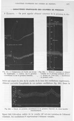 Fig. 344. Compression de l'aorte au niveau du diaphragme/ Fig. 345. Elément constant et élément vari [...]