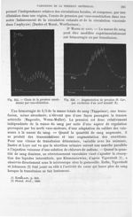 Fig. 355. Chute de la pression carotidienne par vaso-dilatation/ Fig. 356. Augmentation de pression  [...]