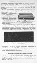 Fig. 365. Appareil de Poiseuille pour démontrer la dilatation des artères/ Fig. 366. Compression d'u [...]