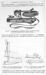 Fig. 371. Sphygmographe à transmission envoyant la pulsation artérielles à un levier inscripteur sit [...]