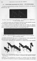 Fig. 376. Type normal du pouls radial grandi/ Fig. 377. types divers du pouls/ Fig. 378. Tracé hémau [...]