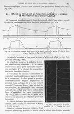 Fig. 379. Courbes de pression dans l'aorte et dans le ventricule gauche chez le chien/ Fig. 380. Pro [...]