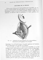 Fig. 172. Dissection de la paroi postérieure de la loge parotidienne. Découverte du nerf hypoglosse  [...]