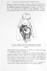 Fig. 219. Dissection des piliers du diaphragme et du ligament suspenseur du pylore chez un nouveau-n [...]