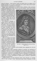 Fig. 102. Dionis 1630?-1718 -  Encyclopédie française d'urologie, publiée sous la direction de MM. A [...]