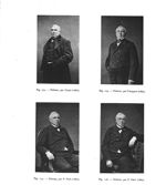 Fig. 173. Nélaton, par Carjat (1862) / Fig. 174. Nélaton, par Trinquart (1862) / Fig. 175. Nélaton,  [...]