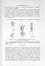 Fig.- 170,171,172.- Procédés de dissection et de suture de l'auteur en cas de section dite continue  [...]