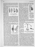 Fig. 124. Anévrismes / Fig. 125. Formes d'anévrismes artério-veineux / Fig. 126. Formation de caillo [...]