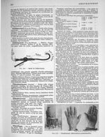 Fig. 414. Sonde de Châtel-Guyon / Fig. 415. Chaudronnier. Déformations professionnelles. - Larousse  [...]