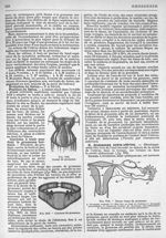 Fig. 968. Corset de grossesse / Fig. 969. Ceinture de grossesse / Fig. 970. Divers types de grossess [...]