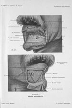 Planche 8. Région mentonnière - Précis-atlas de dissection des régions