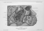 Planche 11. Région de la fosse zygomatique. Contenu de la loge zygomatique - Précis-atlas de dissect [...]