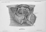 Planche 16. Région sublinguale - Précis-atlas de dissection des régions