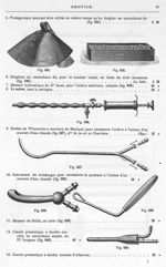 [Instruments pour massage, électrisation, électrolyse, ionisation : olives de Guyon et doigtiers pou [...]