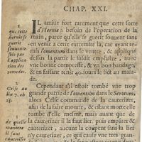 0068 - Page 50 - De l'operation manuelle de l'hernie omentale. Chap. XXI