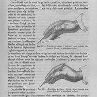 0516 - Page 513 - Incision