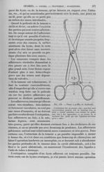 Fig. 134 : Pince à griffes de Koeberlé - Nouveau dictionnaire de médecine de chirurgie pratiques, il [...]