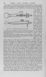 Fig. 137 : Constricteur serre-noeud de Koeberlé - Nouveau dictionnaire de médecine de chirurgie prat [...]