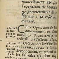 0318 - Page 286 - Des accouchemens des enfans qui venans par le chef ne peuvent venir naturellement & sans l'operation de la main; & premierement de celuy qui a la teste mal tournée
