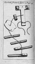 Clavicule fracturée figure 7 - L' appareil commode en faveur des jeunes chirurgiens