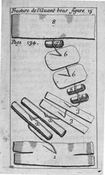 Fracture de l'avant bras figure 15 - L' appareil commode en faveur des jeunes chirurgiens