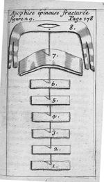 Apophise épineuse fracturée figure 29 - L' appareil commode en faveur des jeunes chirurgiens