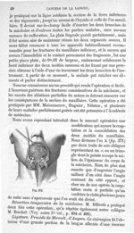 Fig. 371 - Traité de médecine opératoire, bandages et appareils. 4è éd. Tome premier