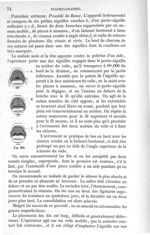 Fig. 382 - Traité de médecine opératoire, bandages et appareils. 4è éd. Tome premier