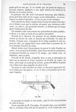 Fig. 383 - Traité de médecine opératoire, bandages et appareils. 4è éd. Tome premier