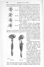 Fig. 406 à Fig. 411 - Traité de médecine opératoire, bandages et appareils. 4è éd. Tome premier