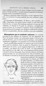 Fig. 442 - Traité de médecine opératoire, bandages et appareils. 4è éd. Tome premier